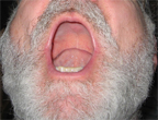 Mouth image 1