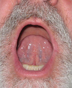 Mouth Sunday image 1 and under toung